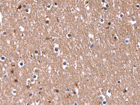 RDX Polyclonal Antibody Store at -20°C