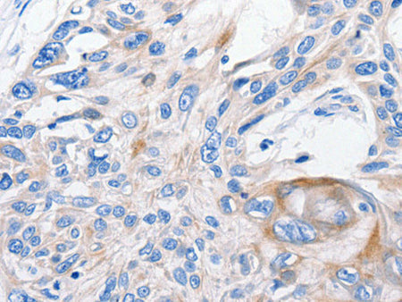 FANCF Polyclonal Antibody Store at -20°C