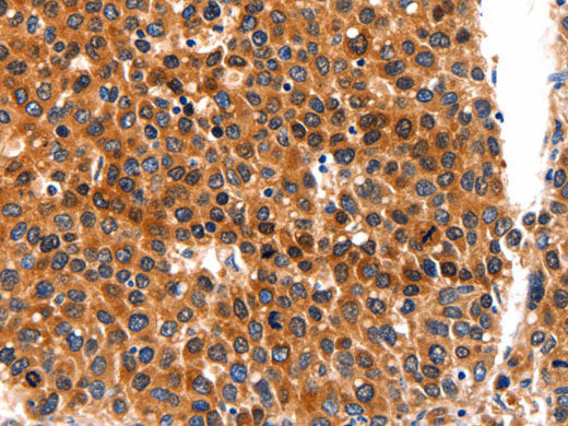 FGFR1 Polyclonal Antibody Store at -20°C