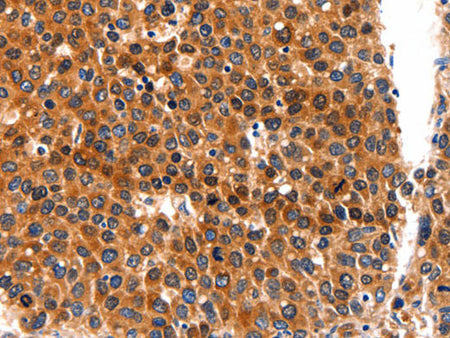 FGFR1 Polyclonal Antibody Store at -20°C