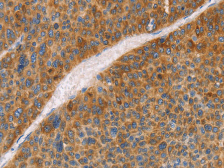 FGL1 Polyclonal Antibody Store at -20°C
