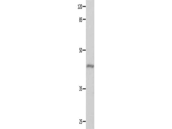 GNA11 Polyclonal Antibody Store at -20°C