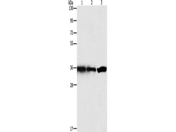 GNB1 Polyclonal Antibody Store at -20°C