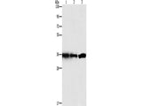 GNB1 Polyclonal Antibody Store at -20°C