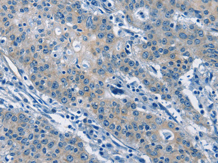 GAS2 Polyclonal Antibody Store at -20°C