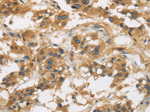 GAS7 Polyclonal Antibody Store at -20°C