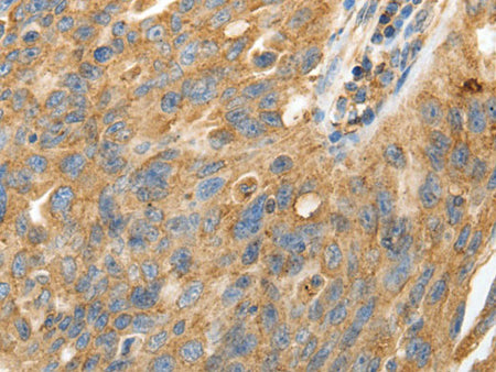 CALR Polyclonal Antibody Store at -20°C