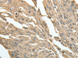 HSP90B1 Polyclonal Antibody Store at -20°C