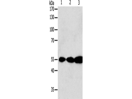 GSR Polyclonal Antibody Store at -20°C