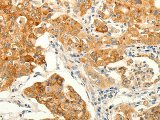 ERG Polyclonal Antibody Store at -20°C