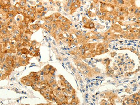 ERG Polyclonal Antibody Store at -20°C
