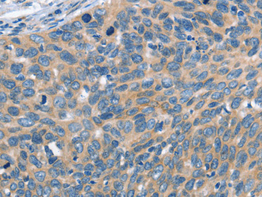 SCARB1 Polyclonal Antibody Store at -20°C