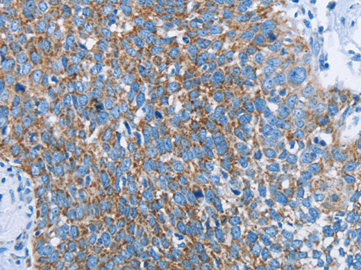 HINT2 Polyclonal Antibody Store at -20°C
