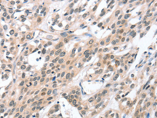 HDAC8 Polyclonal Antibody Store at -20°C