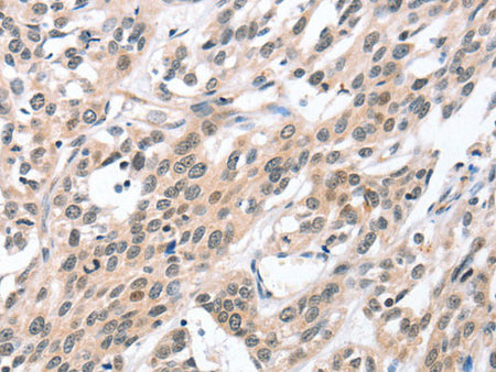 HDAC8 Polyclonal Antibody Store at -20°C