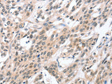HDAC8 Polyclonal Antibody Store at -20°C