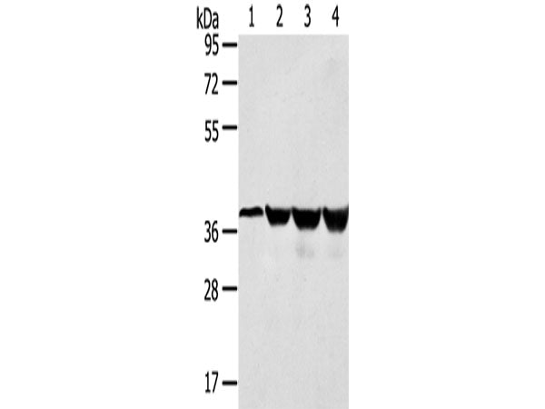 HMOX2 Polyclonal Antibody Store at -20°C