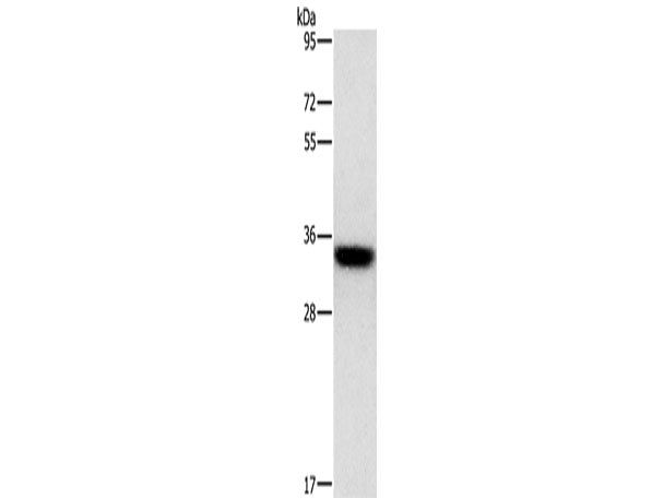 HOXB13 Polyclonal Antibody Store at -20°C