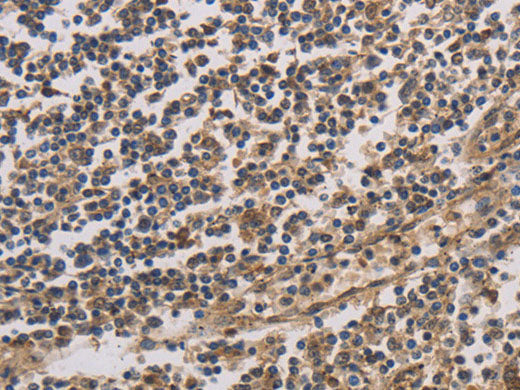 HSF1 Polyclonal Antibody Store at -20°C