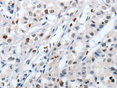 HSPA1A Polyclonal Antibody Store at -20°C