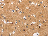 Crystallin-alpha C Polyclonal Antibody