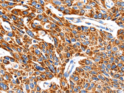 HSP75 Polyclonal Antibody Store at -20°C