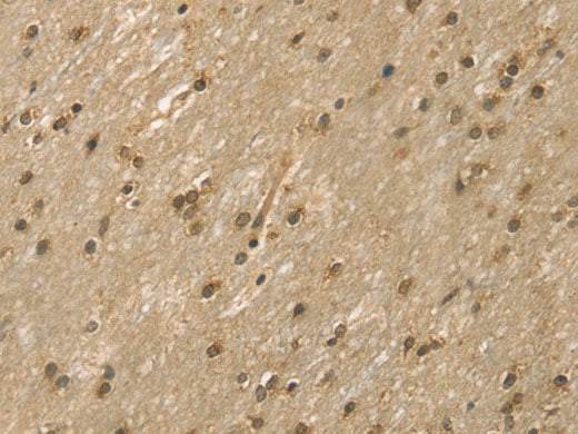 DFFA Polyclonal Antibody