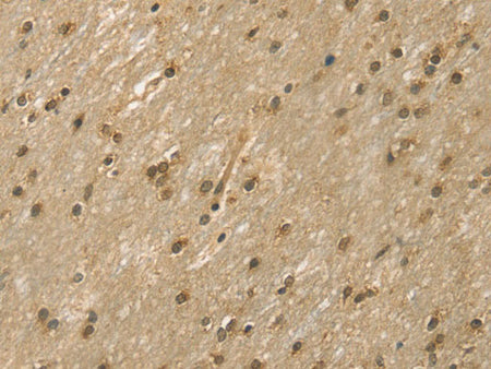 DFFA Polyclonal Antibody