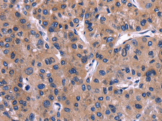 IL1A Polyclonal Antibody Store at -20°C