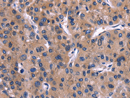 IL1A Polyclonal Antibody Store at -20°C