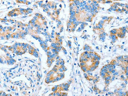 IMMT Polyclonal Antibody Store at -20°C