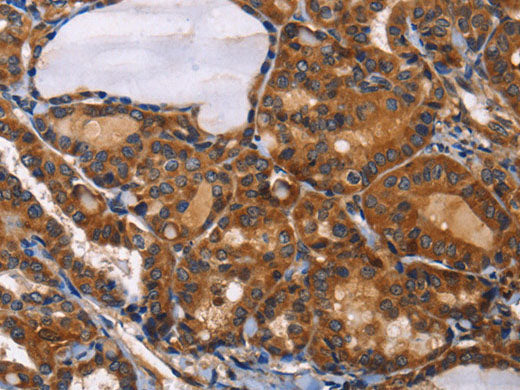 ILK Polyclonal Antibody Store at -20°C