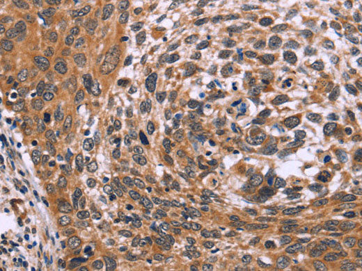 ING2 Polyclonal Antibody Store at -20°C