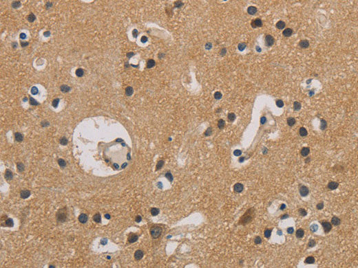 ITGB3BP Polyclonal Antibody Store at -20°C