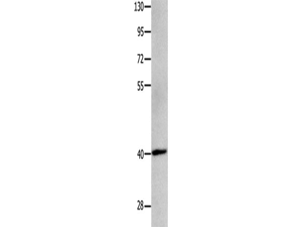 MAGEB4 Polyclonal Antibody