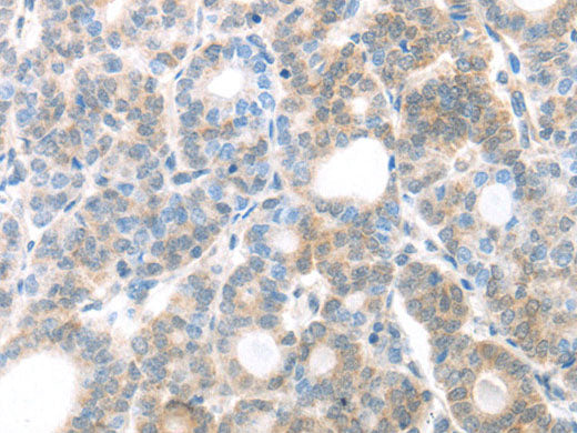 MAGED1 Polyclonal Antibody Store at -20°C