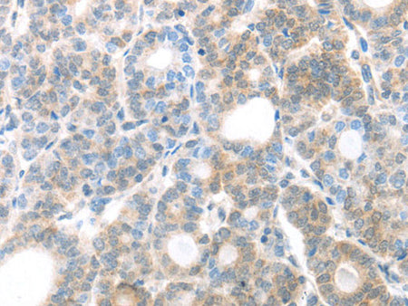 MAGED1 Polyclonal Antibody Store at -20°C