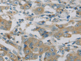 MAP2K6 Polyclonal Antibody Store at -20°C
