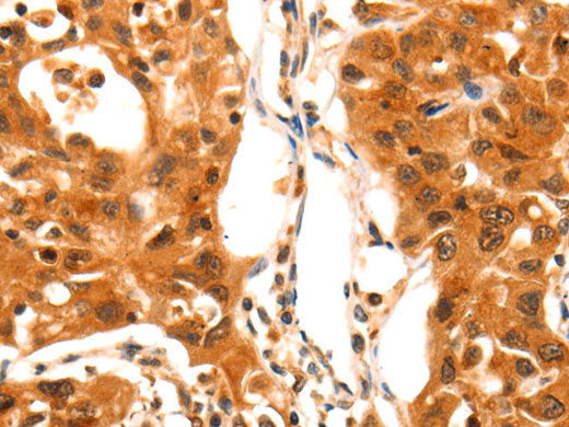 SERPINB5 Polyclonal Antibody Store at -20°C