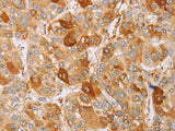CDC46 Polyclonal Antibody Store at -20°C