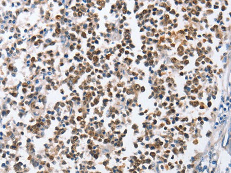 MCM6 Polyclonal Antibody Store at -20°C