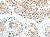 MDK Polyclonal Antibody