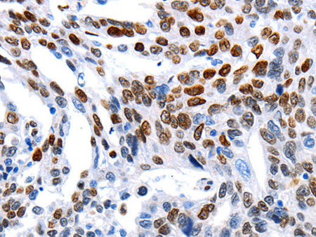 MUTYH Polyclonal Antibody Store at -20°C