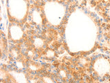 NAP1L1 Polyclonal Antibody Store at -20°C