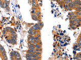 NCK1 Polyclonal Antibody Store at -20°C