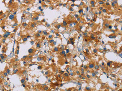 NRN1 Polyclonal Antibody Store at -20°C