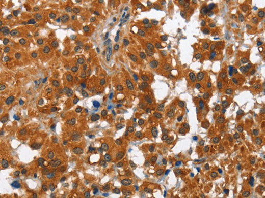 PAK2 Polyclonal Antibody Store at -20°C