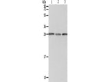 PSMD9 Polyclonal Antibody Store at -20°C