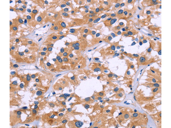 ZEB2 Polyclonal Antibody Store at -20°C - MSE Supplies LLC