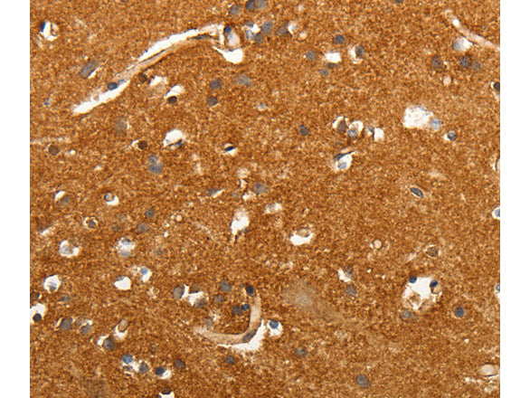 SLC4A4 Polyclonal Antibody Store at -20°C - MSE Supplies LLC